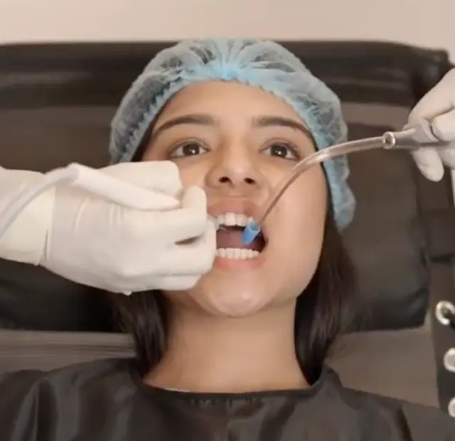 Teeth plaque and calculus removal at home