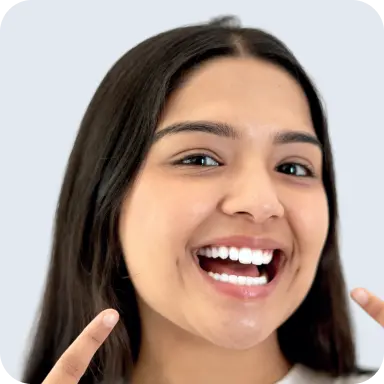 Teeth whitening at home